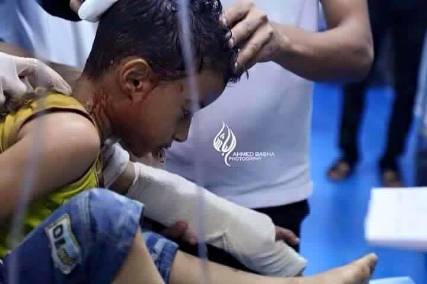 لا تقبروناش: بالفيديو الطفل التعزي الذي أبكى عشرات الآلاف بعد اصابته بقذيفة حوثية