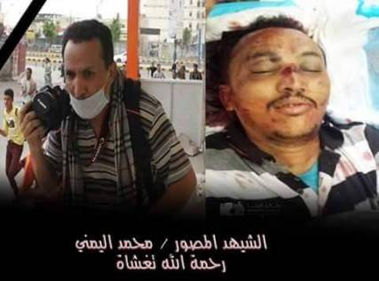نقابة الصحفيين تستنكر جريمة استهداف عدد من المصورين الصحفيين بتعز وتحمل جماعة الحوثي المسؤولية