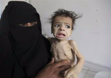 10 محافظات يمنية على حافة كارثة إنسانية (تفاصيل)