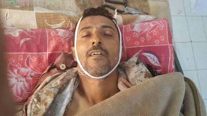 شاهد أول صورة لأركان حرب اللواء 314 والذي قتل في نهم قبل قليل 