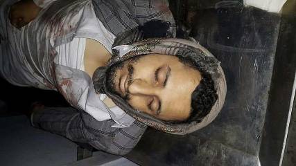 اغتيال قيادي حوثي وسط مدينة إب (صورة)