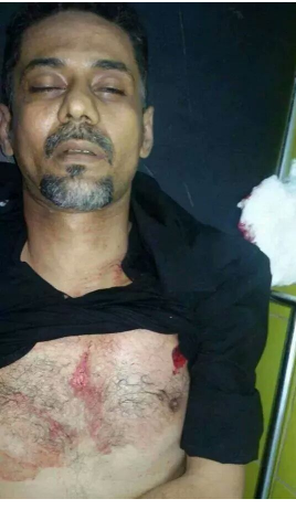 تضارب الروايات حول ملابسات مقتل قيادي بارز في الحراك الجنوبي 