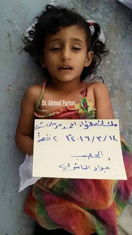 الطفلة "ملاك" دليلا جديدا على إجرام المليشيا بحق أبناء تعز ودافعا قويا لاستكمال عملية التحرير (صور)